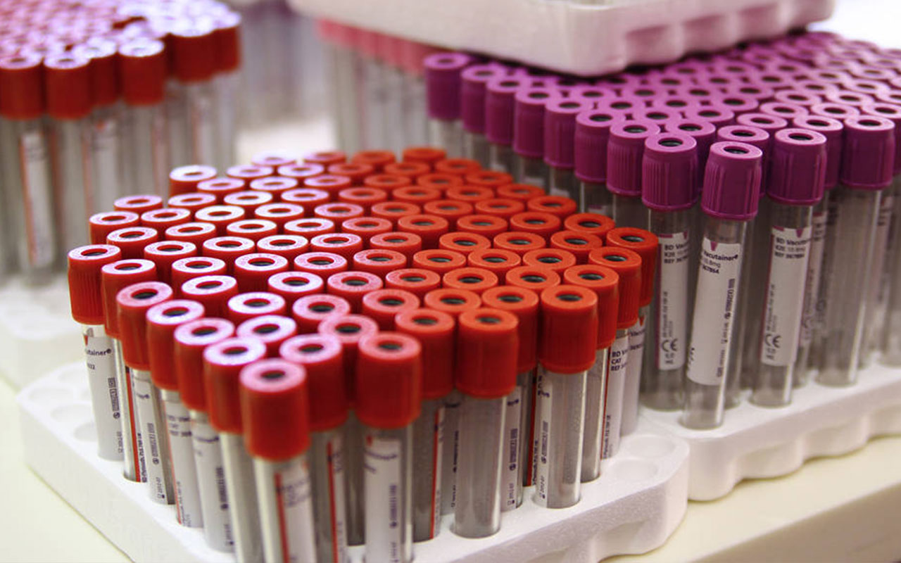 Anvisa divulga dados sobre coleta de sangue umbilical